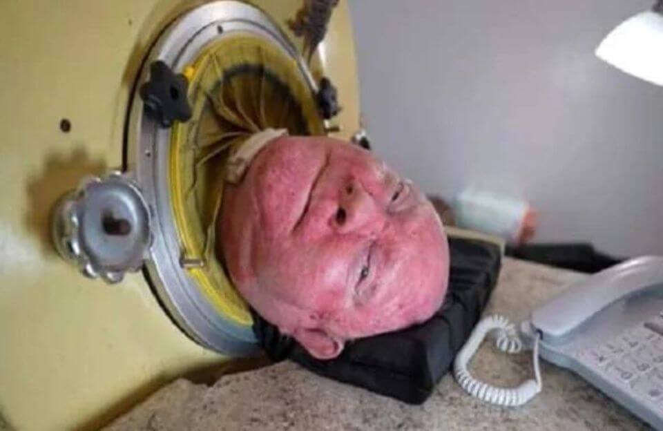 The Inspiring Story of Paul Alexander and His Life in an Iron Lung